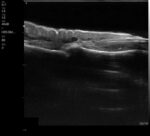 The VSONO-ML3 is a state-of-the-art, handheld linear ultrasound scanner engineered specifically for the nuances of aesthetic medicine and dermatology. By combining ultra-high frequency imaging (up to 22MHz) with a compact, wireless design, the VSONO-ML3 empowers practitioners to visualize facial anatomy with unprecedented clarity, ensuring safer injections and superior patient outcomes.