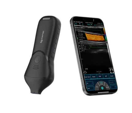 Main Product Image: alt="C10MB PRO high frequency handheld facial ultrasound scanner for filler mapping"
