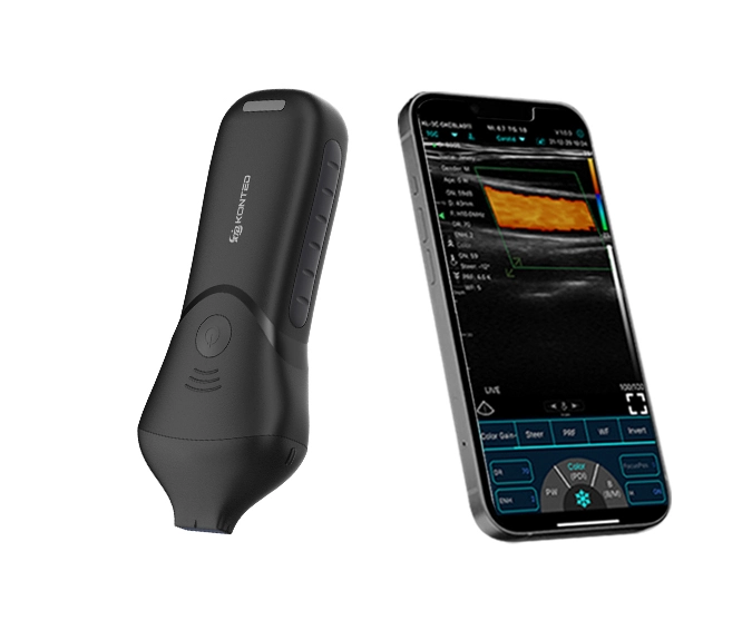 Handheld Facial Ultrasound Scanner Main Product Image: alt="C10MB PRO high frequency handheld facial ultrasound scanner for filler mapping"
