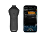 alt="C10MR PRO ultra compact 18 24 MHz handheld facial ultrasound scanner probe"