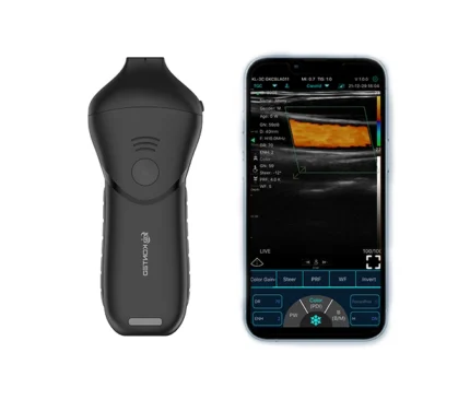 alt="C10MR PRO ultra compact 18 24 MHz handheld facial ultrasound scanner probe"